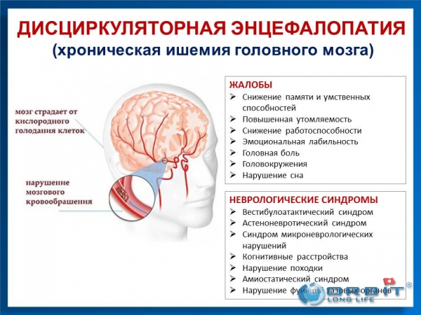Нарушение работы головного мозга симптомы